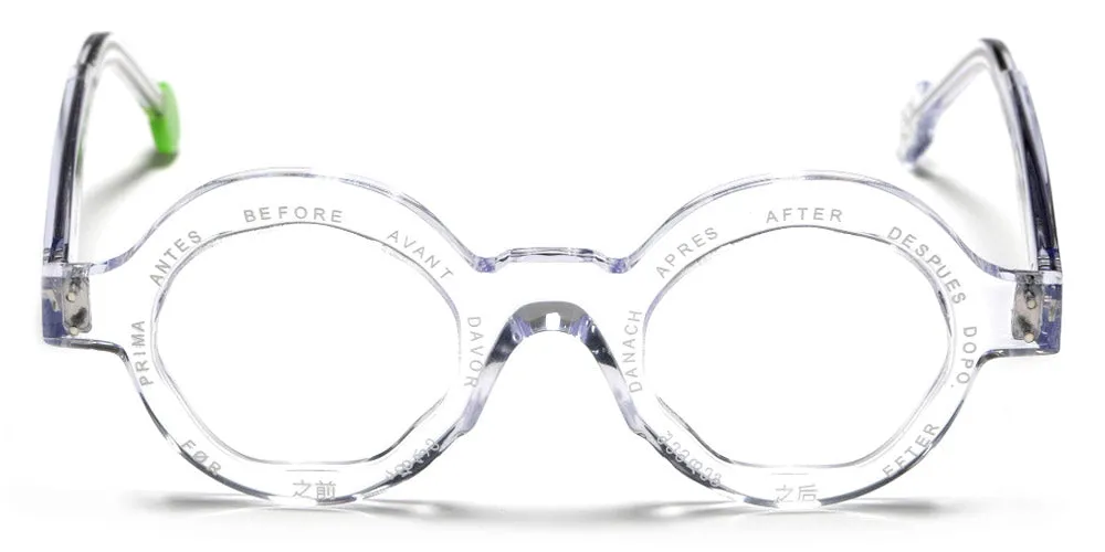 Sabine Be® Before X After
